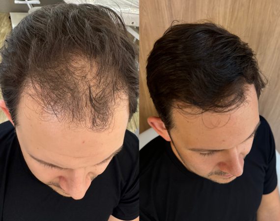 tricologia tratamento capilar