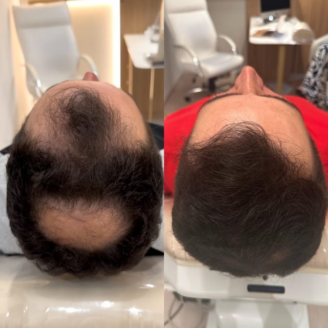 tricologia tratamento capilar